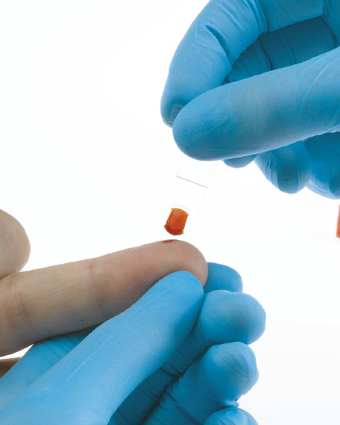 Hemo Control EKF Diagnóstica Peruana